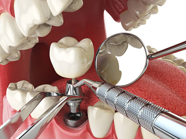 Best Walk-In Emergency Dental Services in Alvord, TX