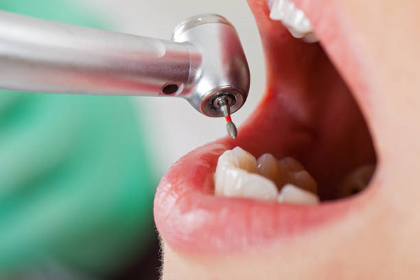 Best Emergency Dental Care for Sports Injuries in Alvord, TX